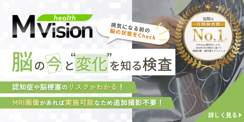 MVision
