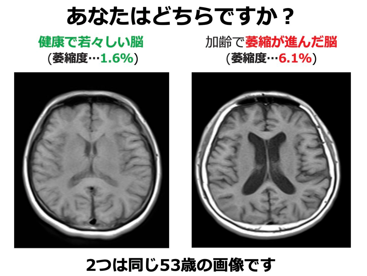 MVision health：あなたはどちらですか？