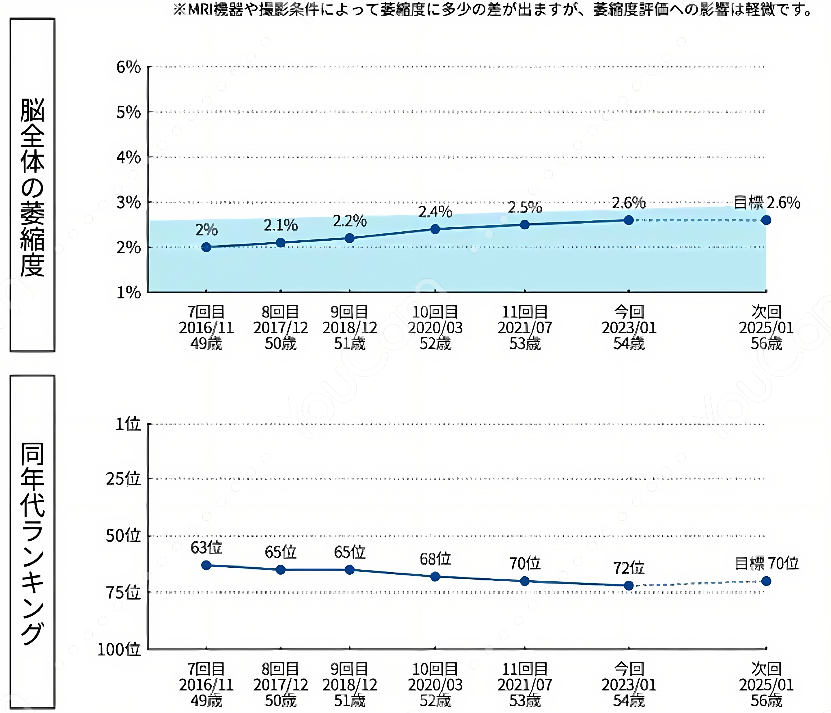 MVision health：脳全体の萎縮度