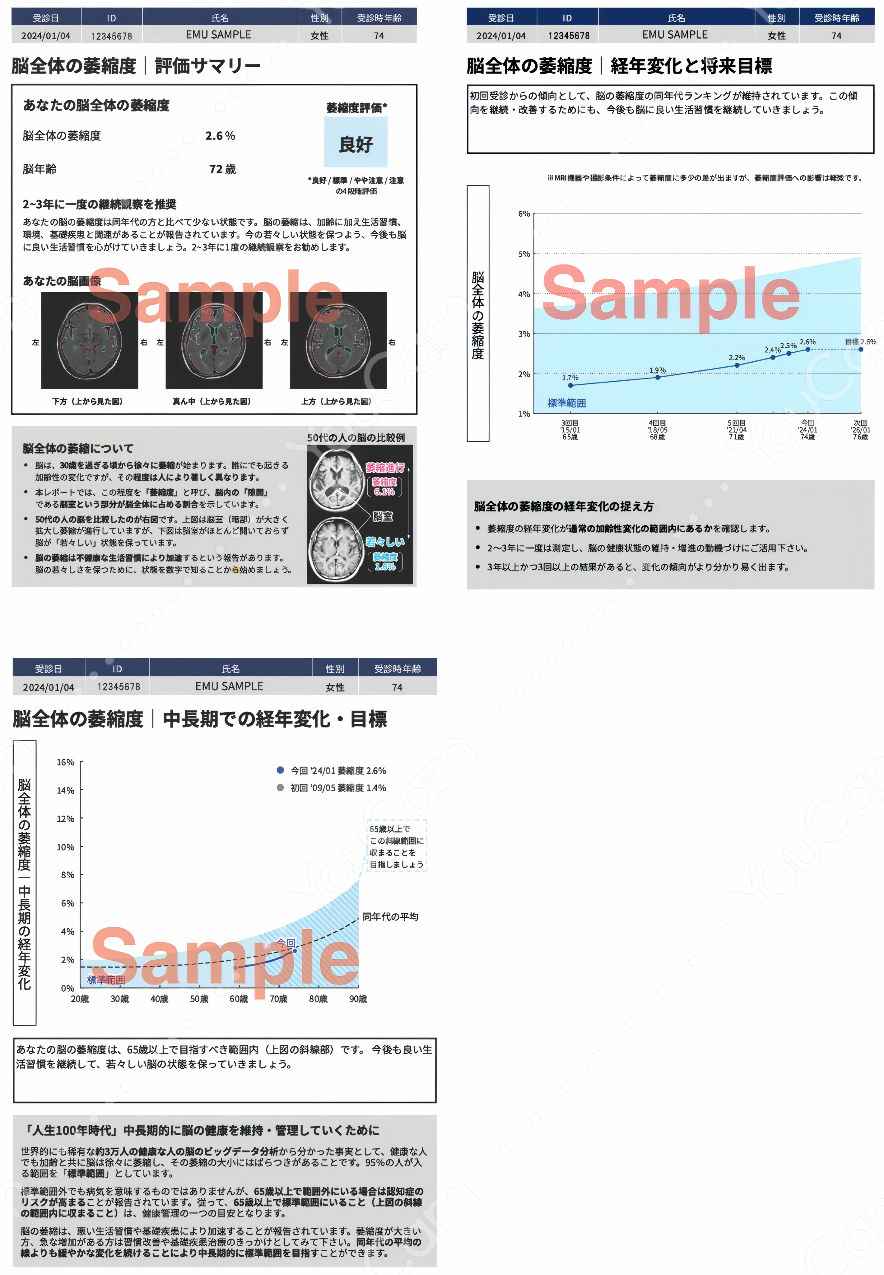 MVision health：サンプルレポート