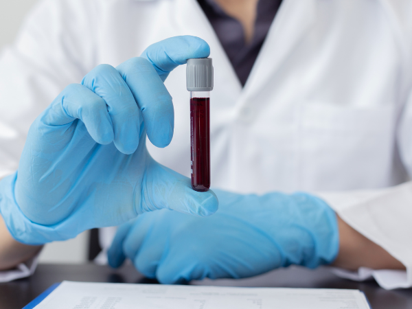 MCIスクリーニング検査