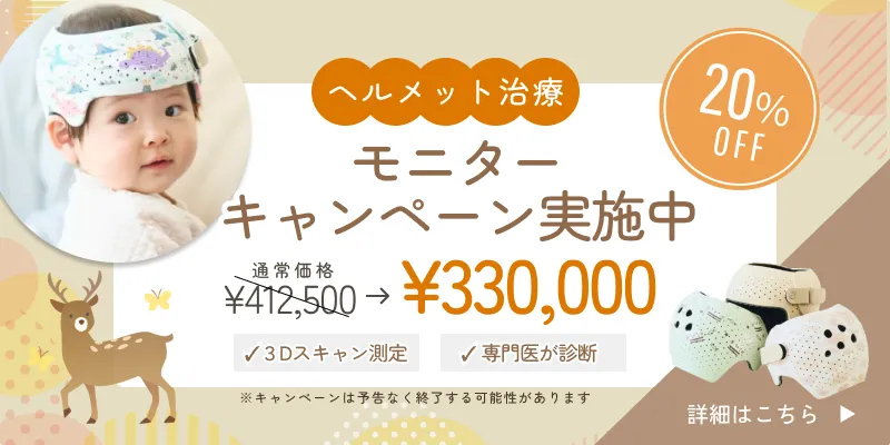 ヘルメット治療モニターキャンペーンバナー