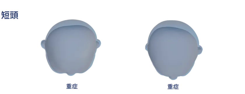治療前後イメージ 2