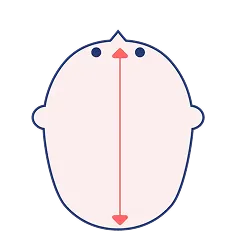 長頭症
