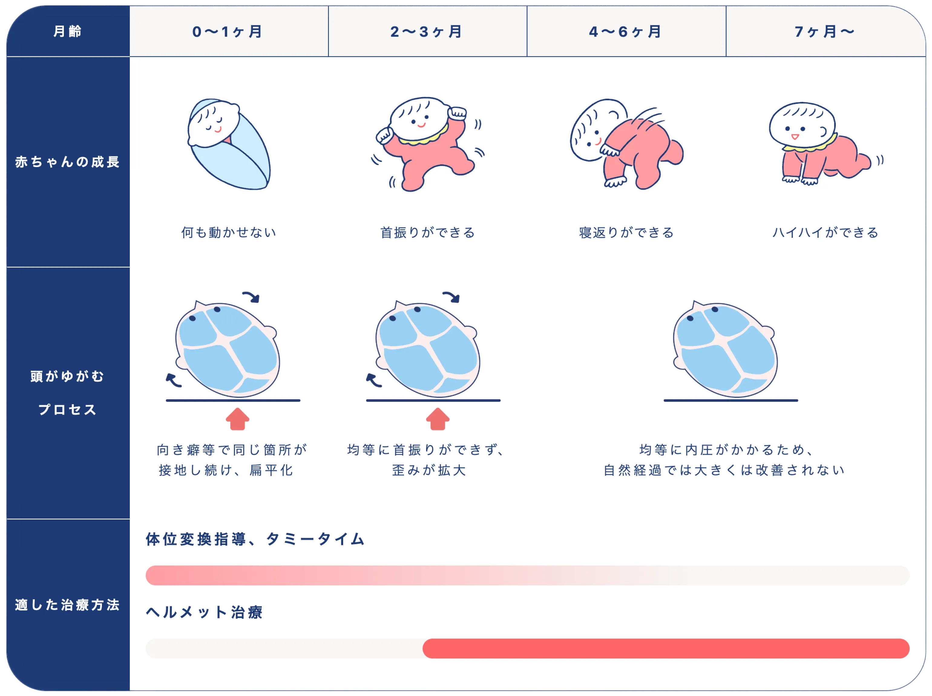 ヘルメット治療を始めるタイミングの目安