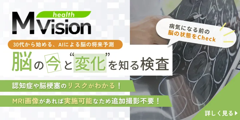 mVision 脳ドック