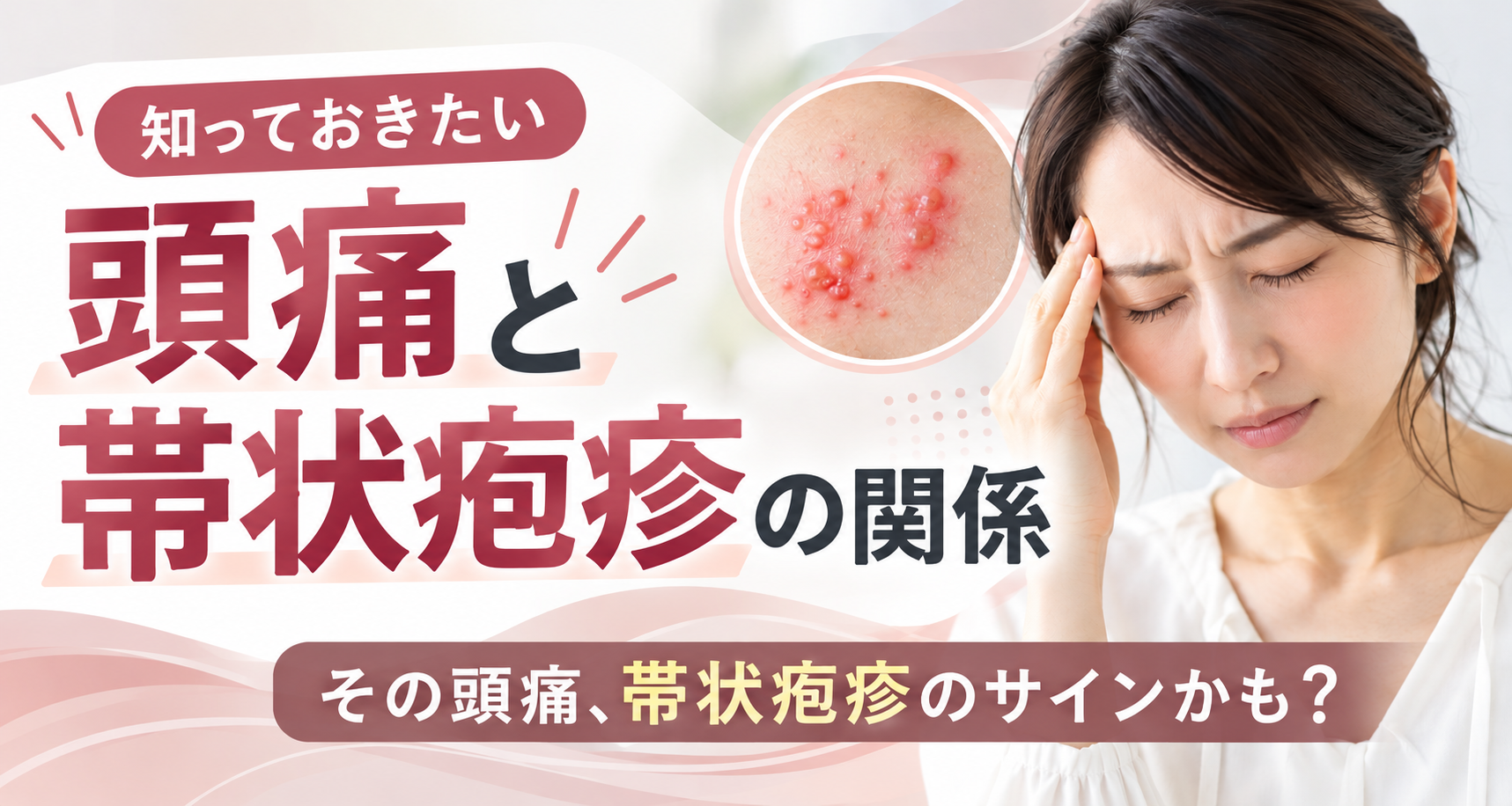 頭痛と帯状疱疹の関係｜頭の痛みはいつまで続く？治療法を脳神経外科医が解説
